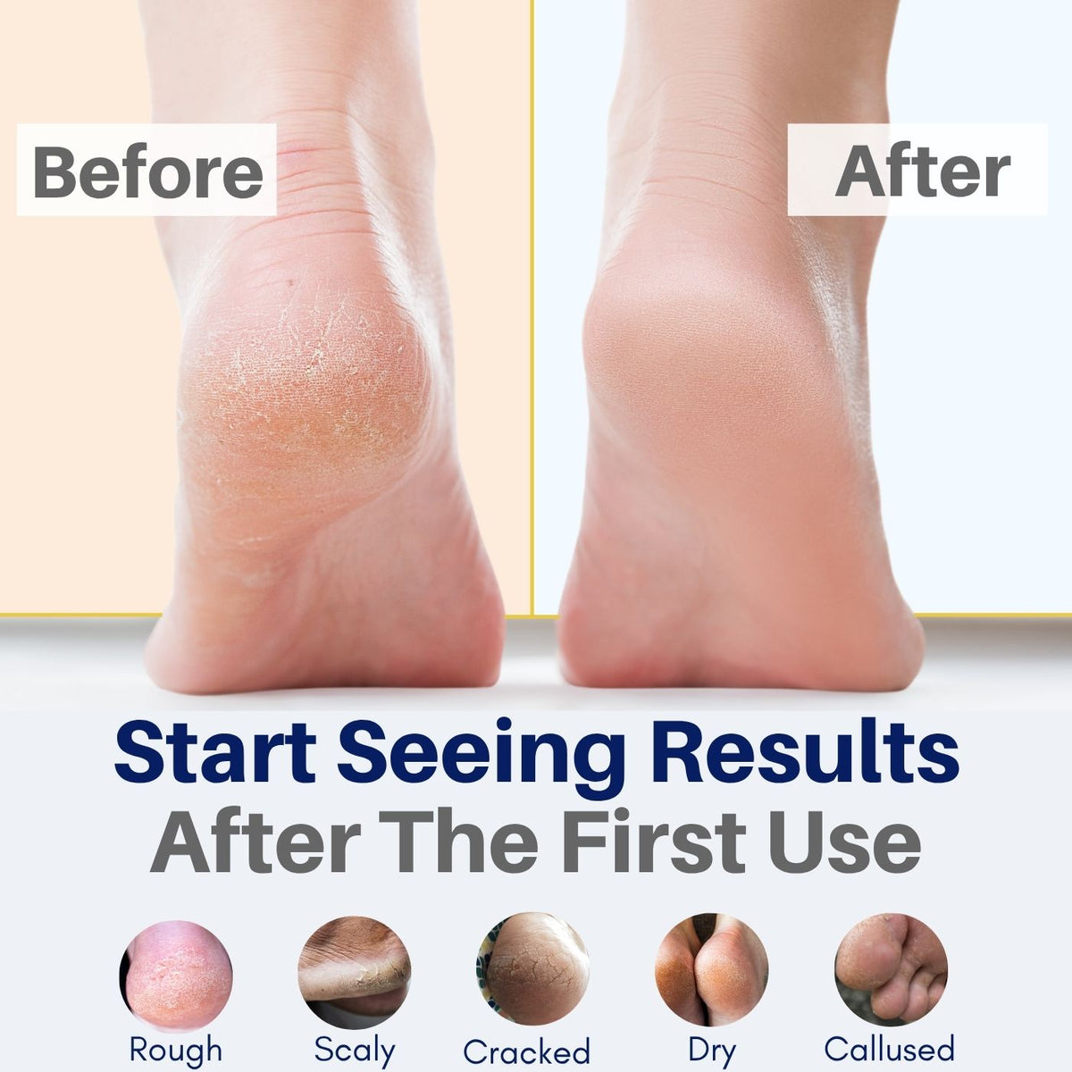 All Natural Foot Cream